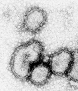 A real influenza virion