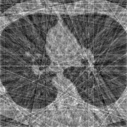 A faulty CT scan with lines crossing over it