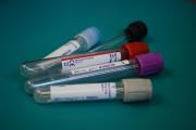 Blood test tubes