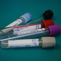 Blood test tubes